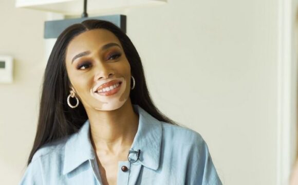 Winnie Harlow Net Worth 2021